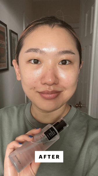 Allure commerce editor Sarah Han after using the CosRx BHA Blackhead Power Liquid for 3 weeks